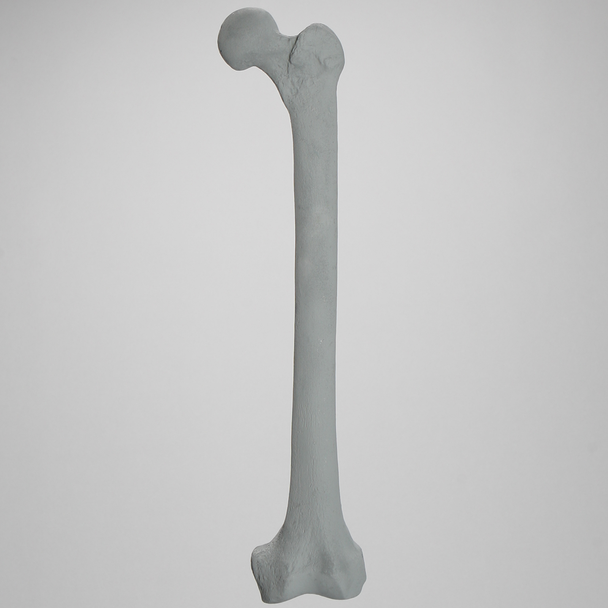 Femur, Radiopaque, Left