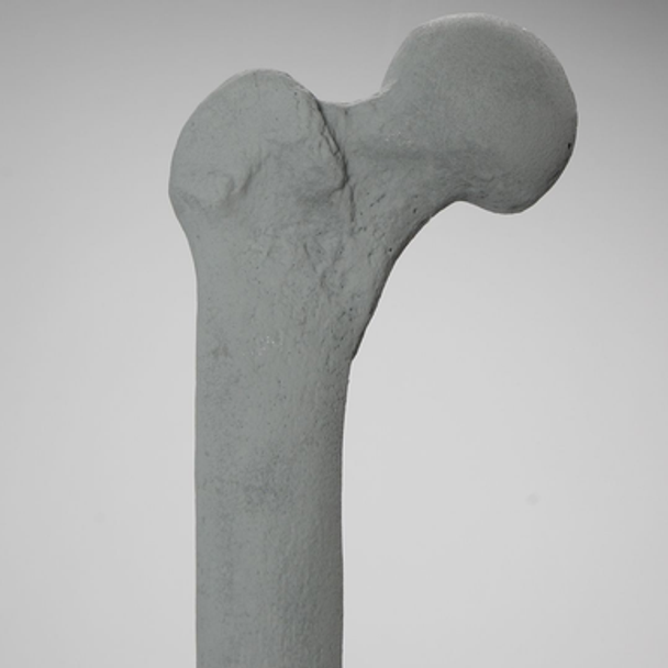 Femur, Radiopaque, Right