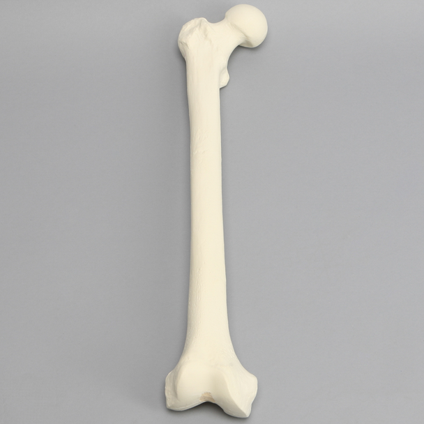 Femur, 16 mm Canal, Foam Cortical, Right