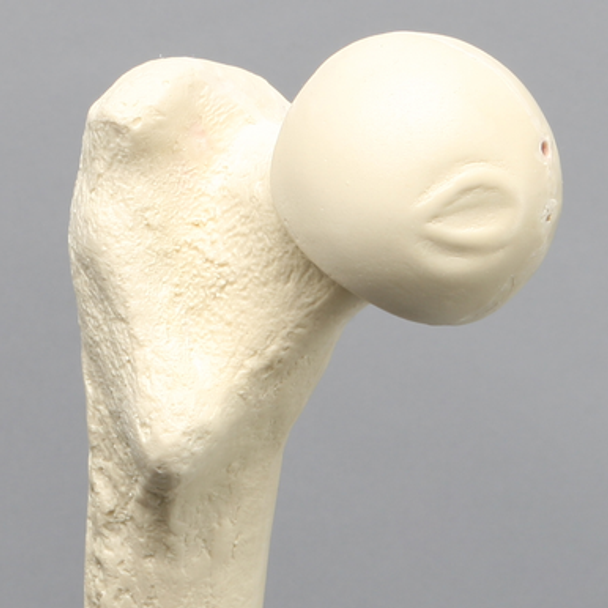 Femur, 16 mm Canal, Solid Foam, Left