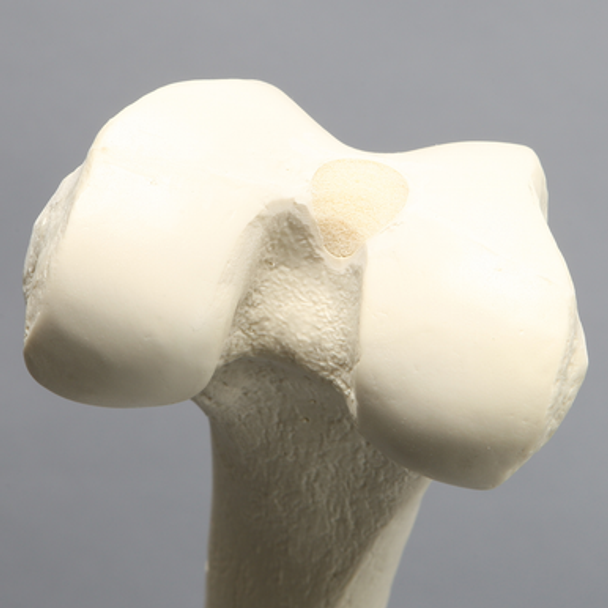 Femur, 16 mm Canal, Solid Foam, Left