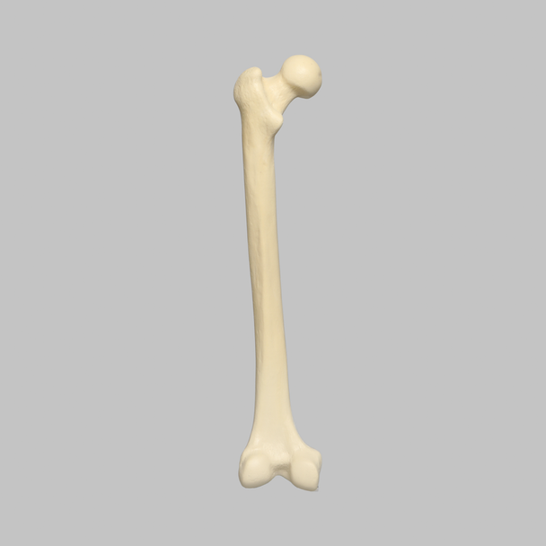 Femur, 16 mm Canal, Solid Foam, Left