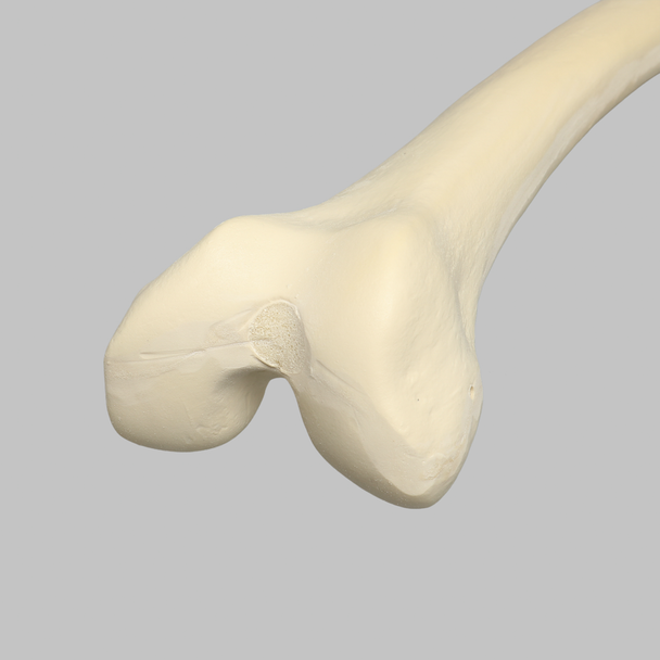 Femur, 16 mm Canal, Solid Foam, Left