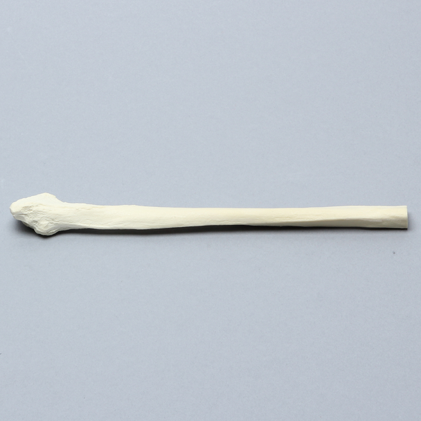 Fibula, Distal, Solid Foam, Left