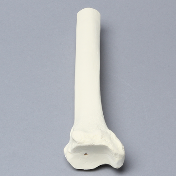 Tibia, Distal, Foam Cortical, Left