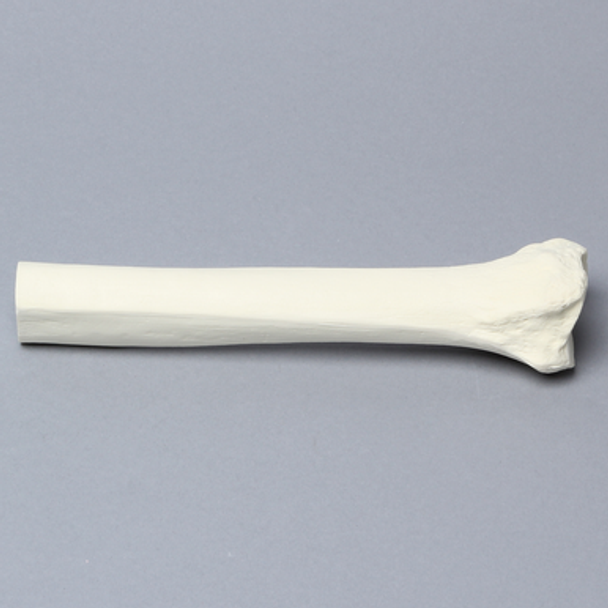Tibia, Distal, Foam Cortical, Left