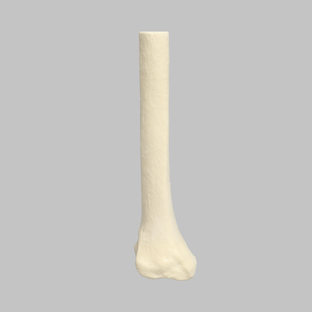 Tibia, Distal, Foam Cortical, Left