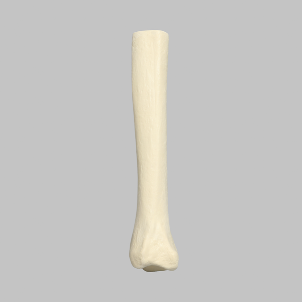Tibia, Distal, Foam Cortical, Left