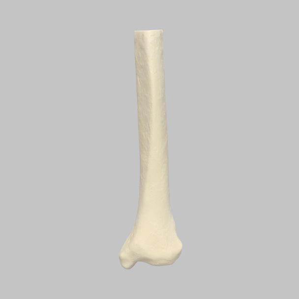 Tibia, Distal, Foam Cortical, Left