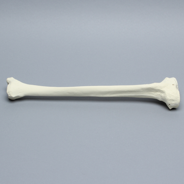 Tibia for IM Nail with Distal Window