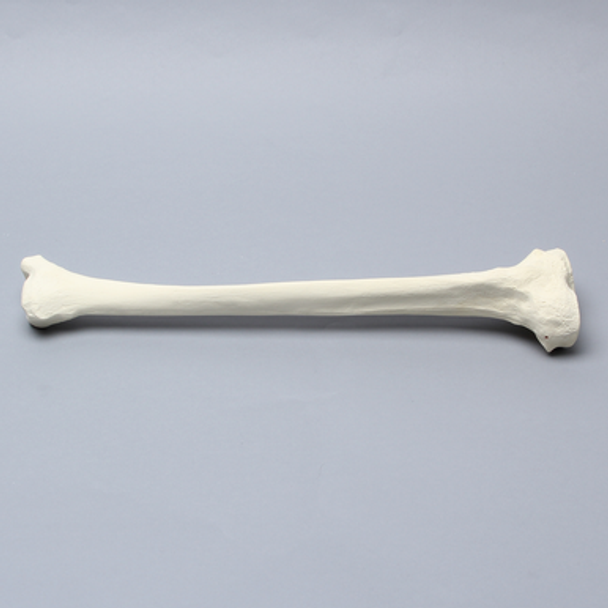 Tibia for High Tibial Osteotomy H.T.O.