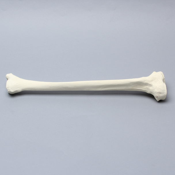 Tibia for High Tibial Osteotomy H.T.O.