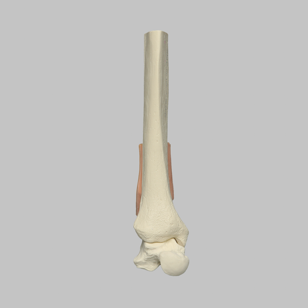 Tibia with Skin Patch and Talus