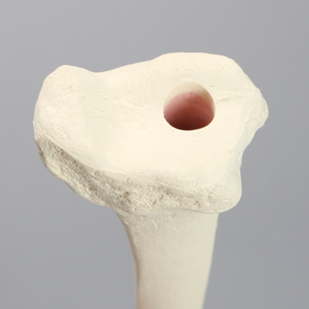Tibia, Foam Cortical, Left