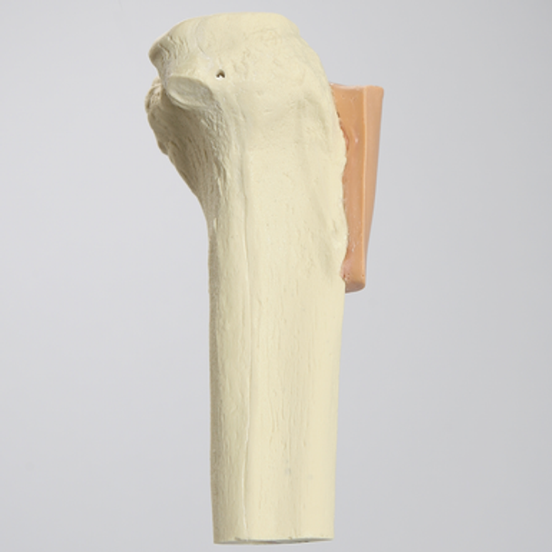 Tibia with Skin Patch, Proximal