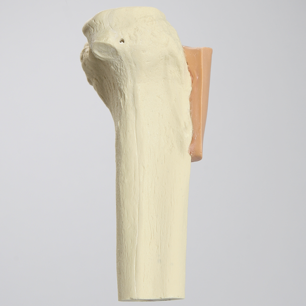 Tibia with Skin Patch, Proximal