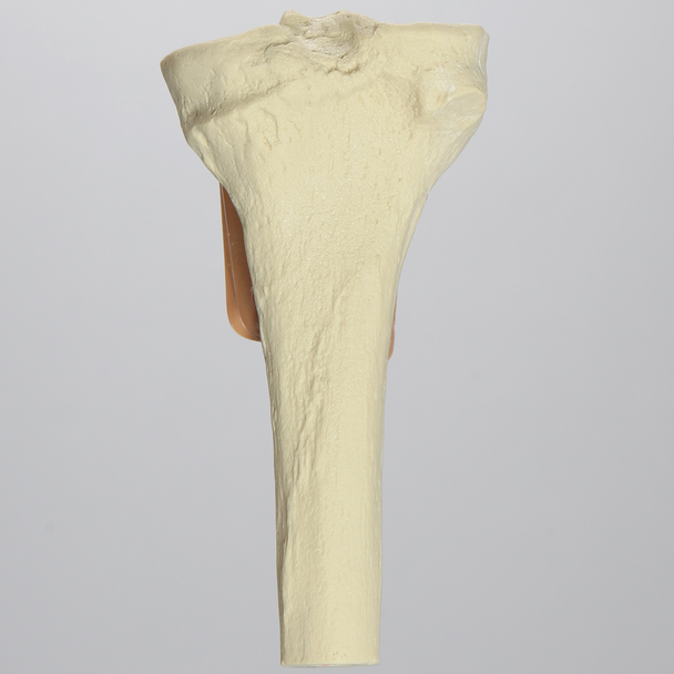 Tibia with Skin Patch, Proximal