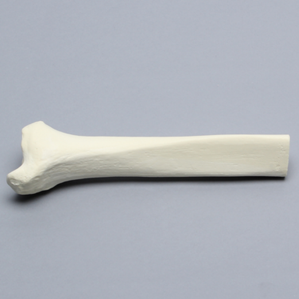 Tibia, Distal, Solid Foam, Right