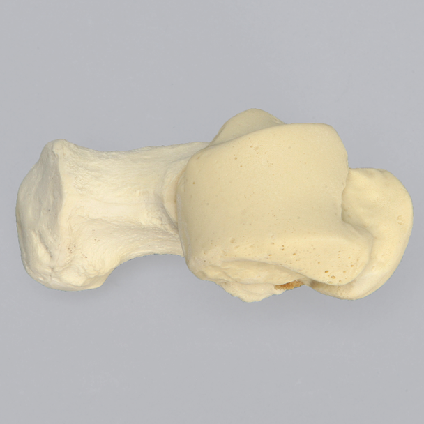 Talus and Calcaneus, Talocalcaneal Joint, Solid Foam