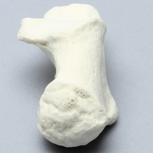 Calcaneus, Solid Foam, Right