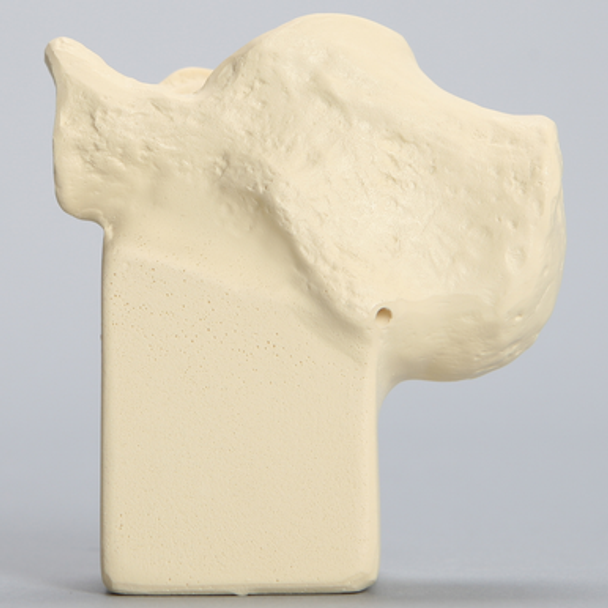 Calcaneus, High Density, Foam Cortical, Left