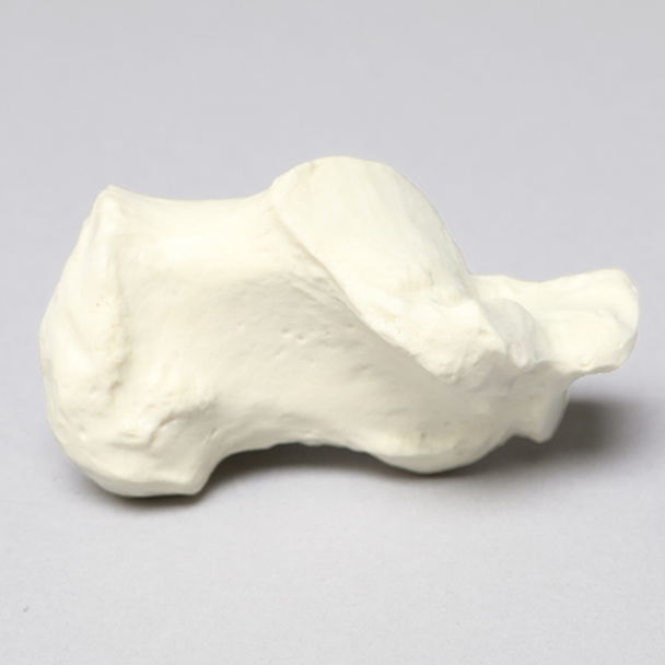 Calcaneus, Foam Cortical, Left