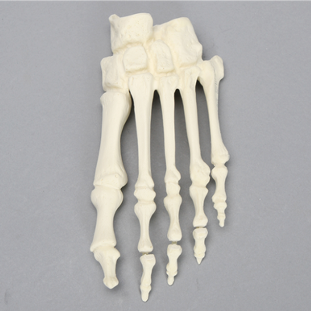 Forefoot with Articulation at the Interphalangeal Joint, Solid Foam, Left