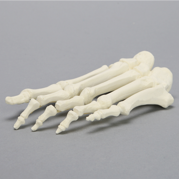 Forefoot with Articulation at the Interphalangeal Joint, Solid Foam, Left