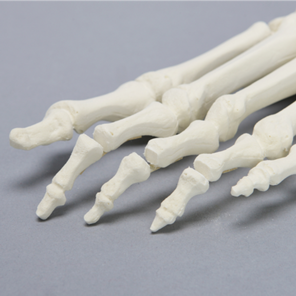 Forefoot with Articulation at the Interphalangeal Joint, Solid Foam, Left