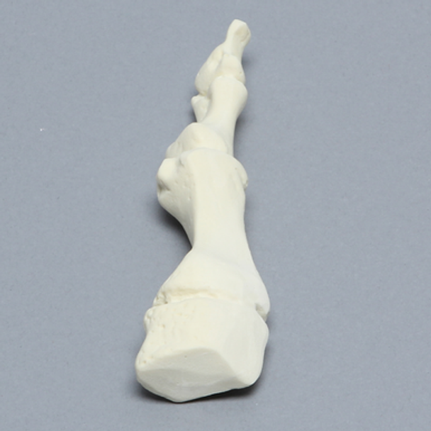 Metatarsal, First, Solid Foam, Left, Large