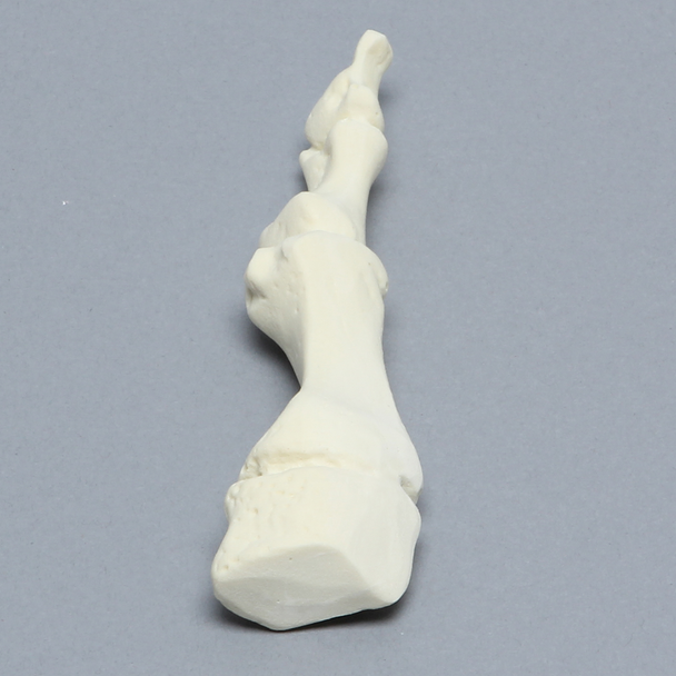 Metatarsal, First, Solid Foam, Left, Large