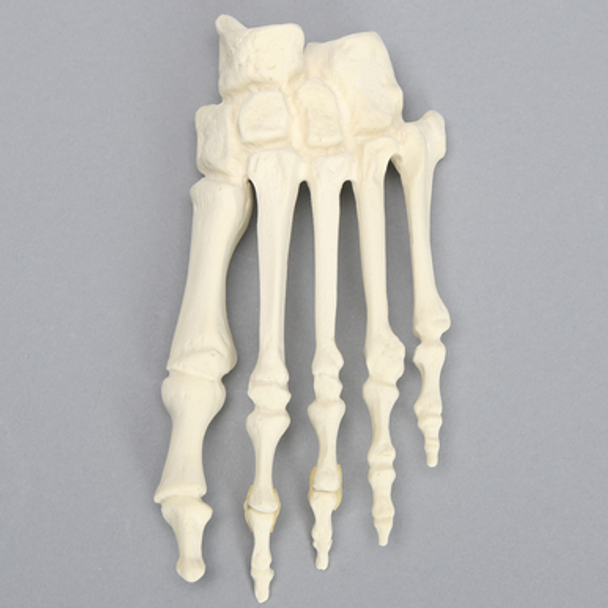 Forefoot with Hammertoe, Foam Cortical, Left, Large