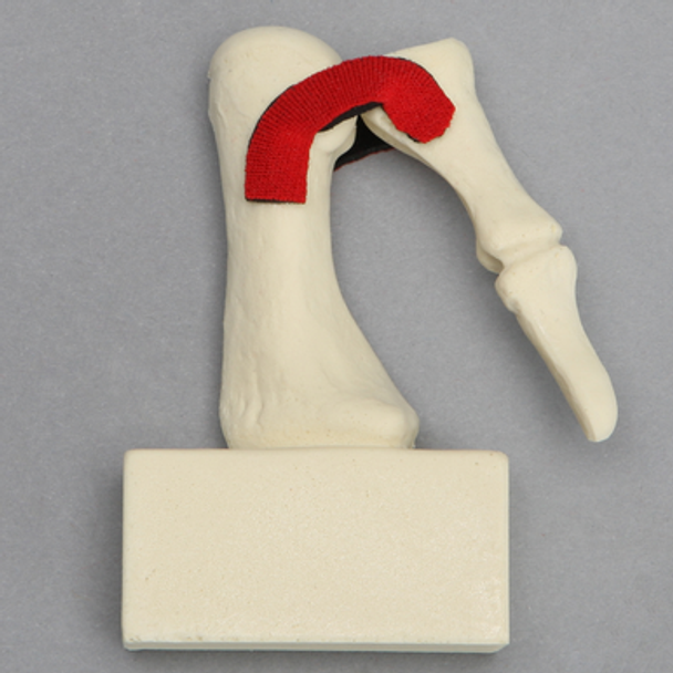 Metatarsal with Articulation and Ligaments, Solid Foam, Left