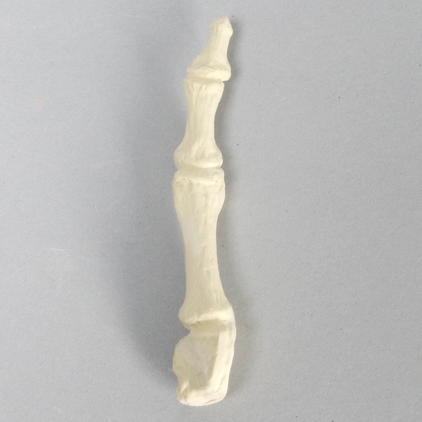 Metatarsal, First, Solid Foam, Right, Large