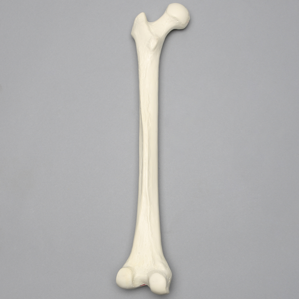 Femur, 14 mm, Trochanteric Entry Site, Foam Cortical