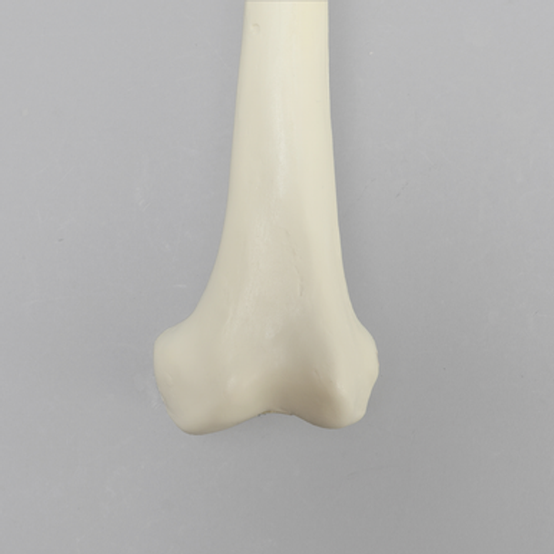 Femur with Average Asian Anatomical Attributes, Foam Cortical Shell, Left