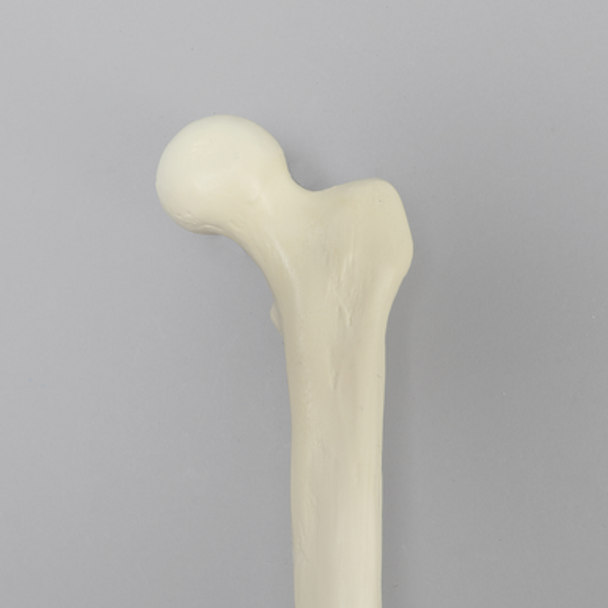 Femur with Average Asian Anatomical Attributes, Foam Cortical Shell, Left