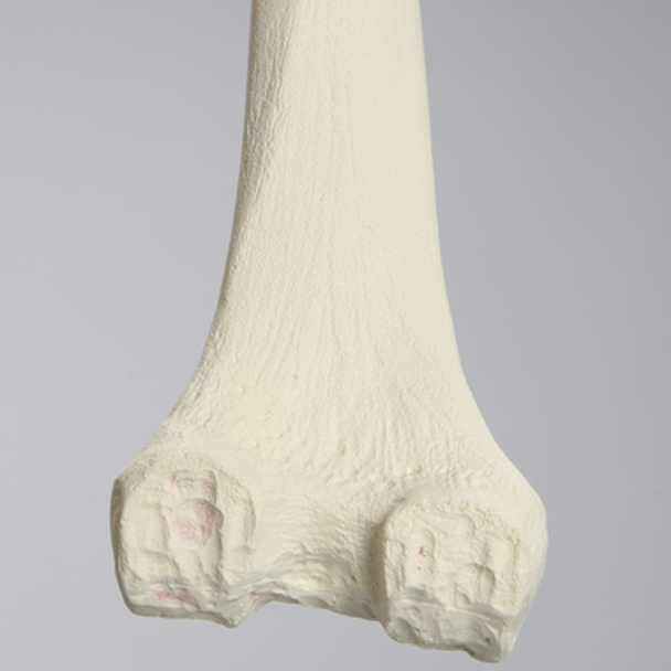 Femur with Revision Cuts, Foam Cortical, Left