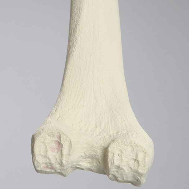 Femur with Revision Cuts, Foam Cortical, Left