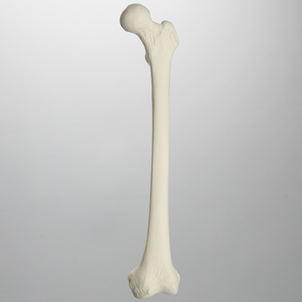 Femur with Light Density Cancellous