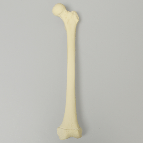 Femur with Defined Distal Growth Plate