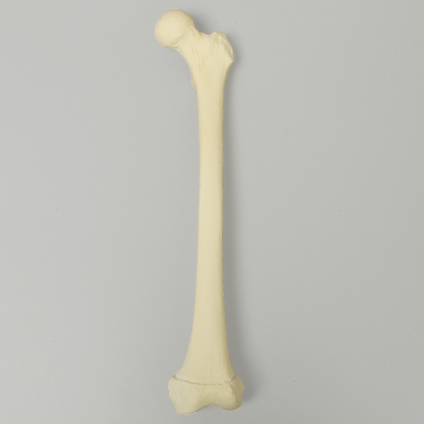 Femur with Defined Distal Growth Plate