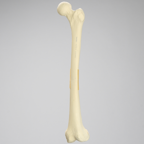 Femur with Transverse Fracture, Foam Cortical, Left, Small