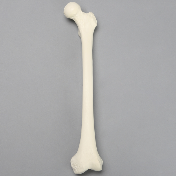 Femur, 9.5 mm Canal, Foam Cortical, Left, Small