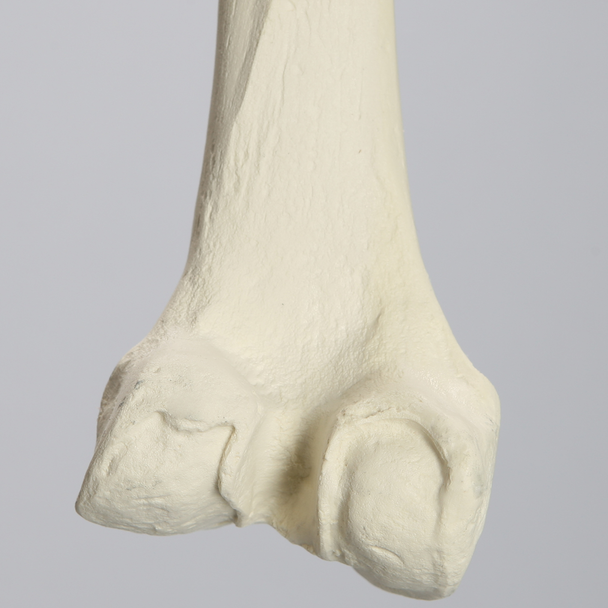 Femur with Arthritis, Foam Cortical, Left, Medium