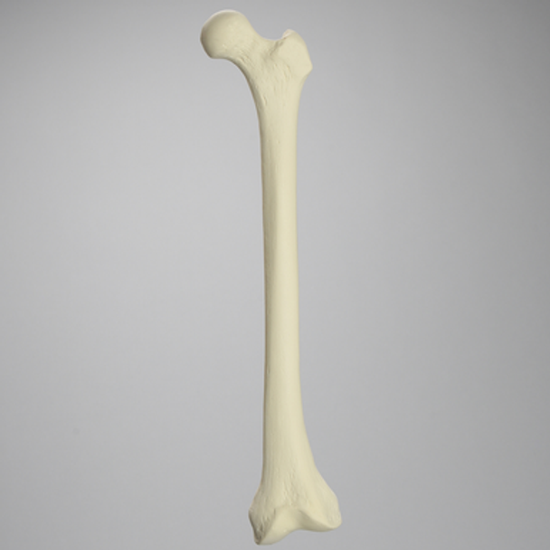 Femur, 10 Degree Distal Valgus Deformity, Foam Cortical, Left