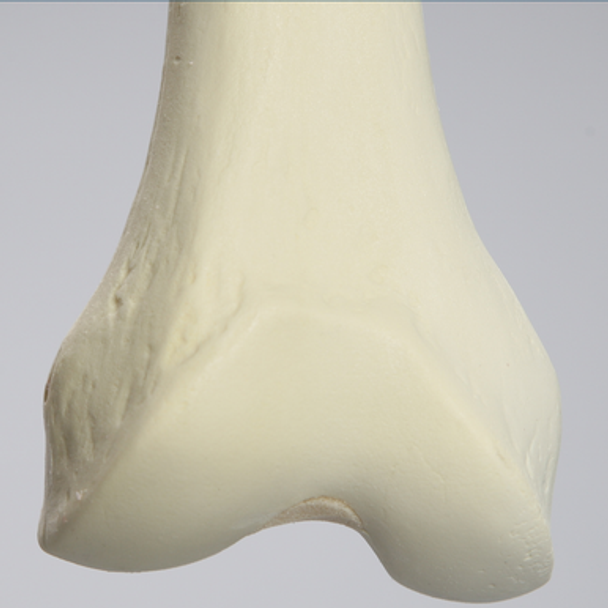 Femur, 15 mm Canal, Foam Cortical, Right, Medium