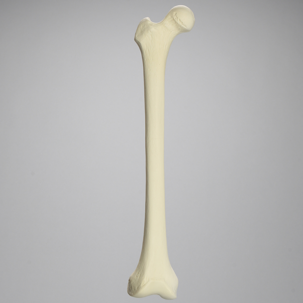 Femur, 15 mm Canal, Foam Cortical, Right, Medium