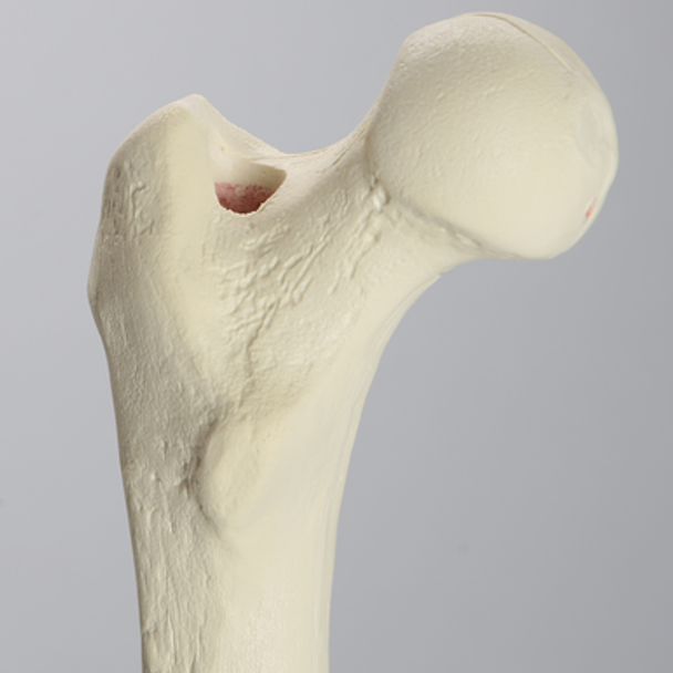 Femur for IM Nail with 15 mm, Foam Cortical, Left, Medium