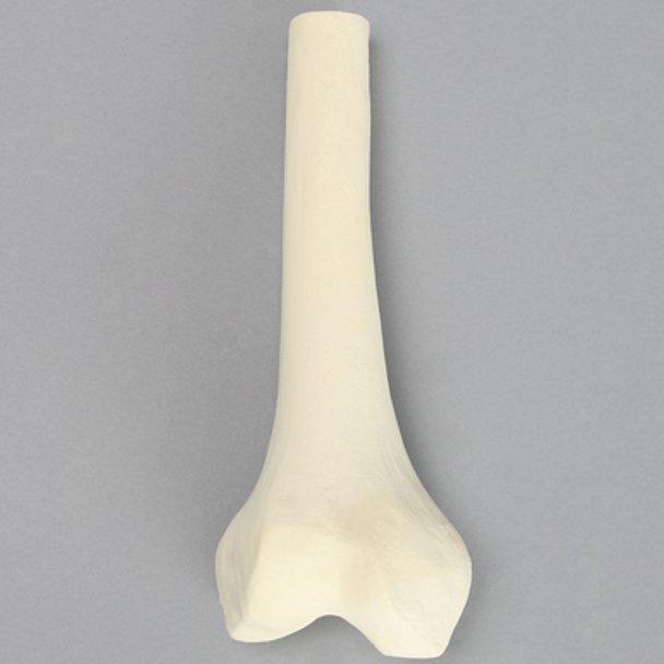 Femur, Distal with 15 mm Canal, Right